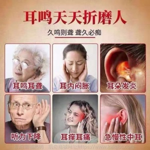 【三秒止耳鸣】耳鸣耳聋神经性听力下降耳背耳朵嗡嗡响耳康贴恢复