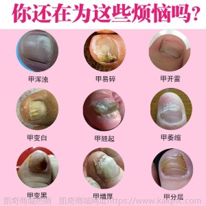 [买2送1]廖生堂灰甲修复液去灰指甲手足灰指甲专用美甲亮甲正品