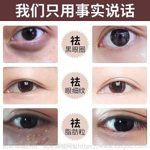脂肪粒去除神器去脂肪粒眼霜眼部精华去除油脂粒汗管留眼细纹眼霜