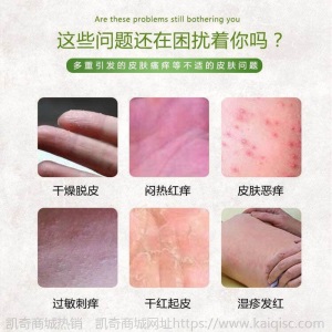 苗药止痒膏快速止痒皮肤湿疹膏过敏皮肤瘙痒抑菌消毒止痒药膏20g