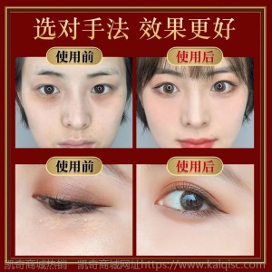 脂肪粒去除神器去脂肪粒眼霜眼部精华去除油脂粒汗管留眼细纹眼霜