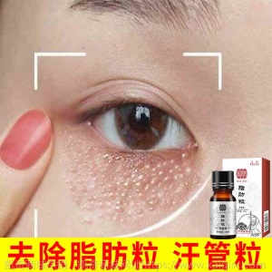 脂肪粒去除神器去脂肪粒眼霜眼部精华去除油脂粒汗管留眼细纹眼霜