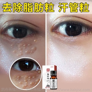 脂肪粒去除神器去脂肪粒眼霜眼部精华去除油脂粒汗管留眼细纹眼霜
